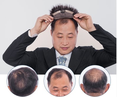 Tóc giả nam nguyên đầu siêu da đầu 100% tóc thật thời trang