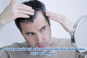 cách chữa hói đầu bẩm sinh
