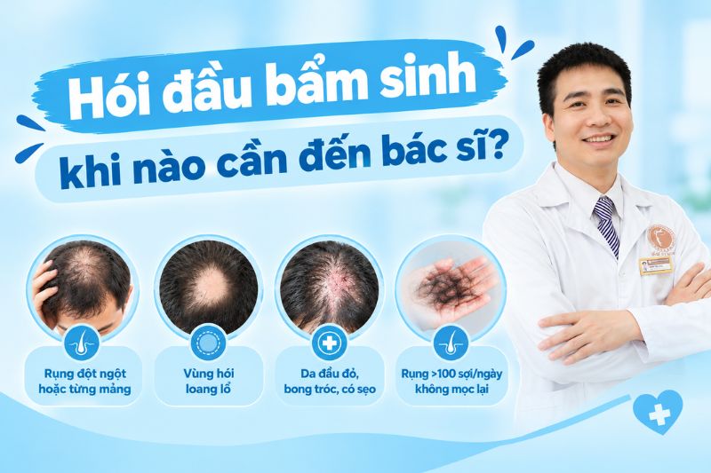 hói đầu bẩm sinh khi nào cần đến bác sĩ 