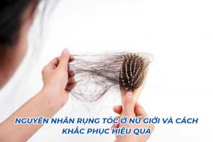 nguyên nhân rụng tóc ở nữ giới