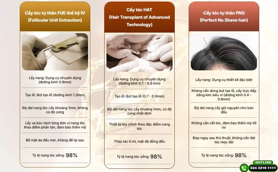 lựa chọn phương pháp cấy tóc