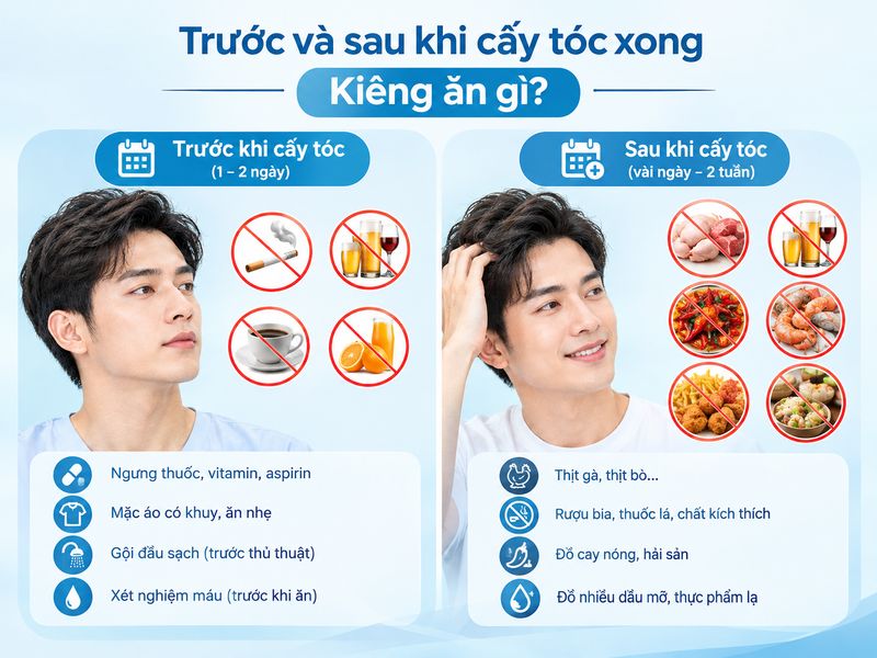 trước và sau khi cấy tóc xong nên kiêng gì 