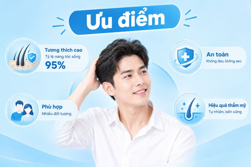 ưu điểm phương pháp cấy tóc